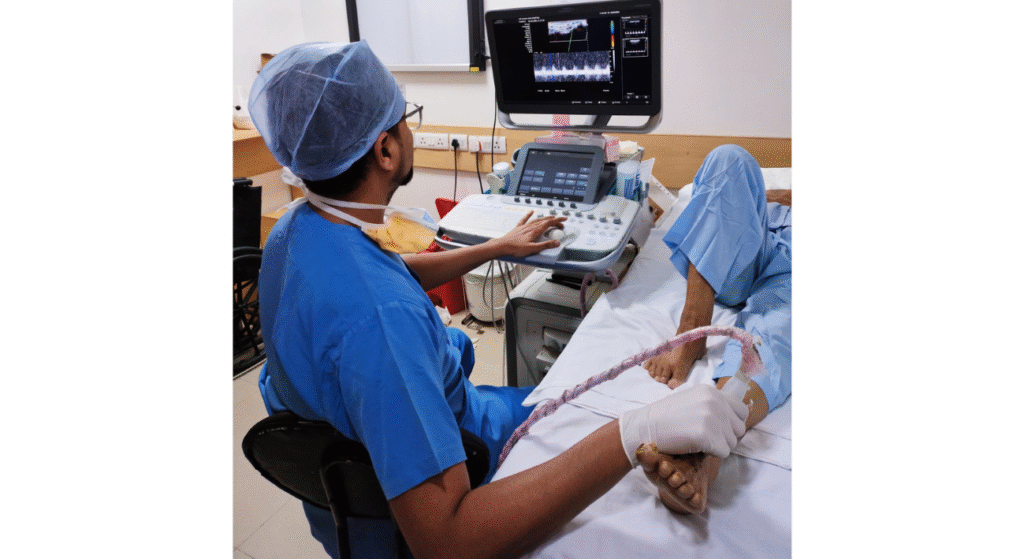 Doppler examination for varicose veins