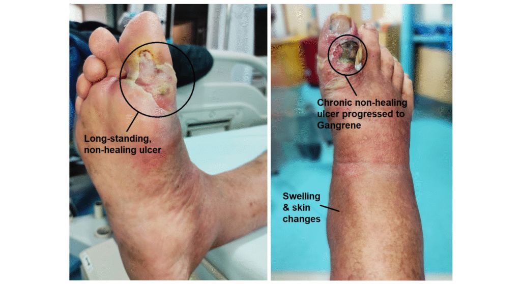 Signs you need to see a vascular surgeon